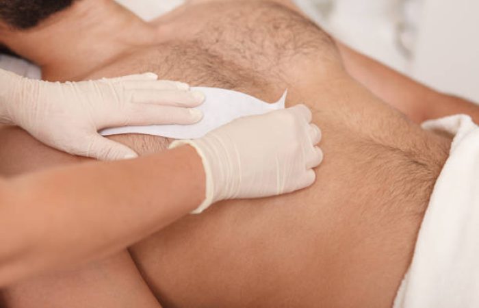Cosmetologist doing waxing on torso of unrecognizable male client Cosmetologist doing waxing on torso of unrecognizable male client